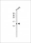 VKORC1 Antibody (N-term)